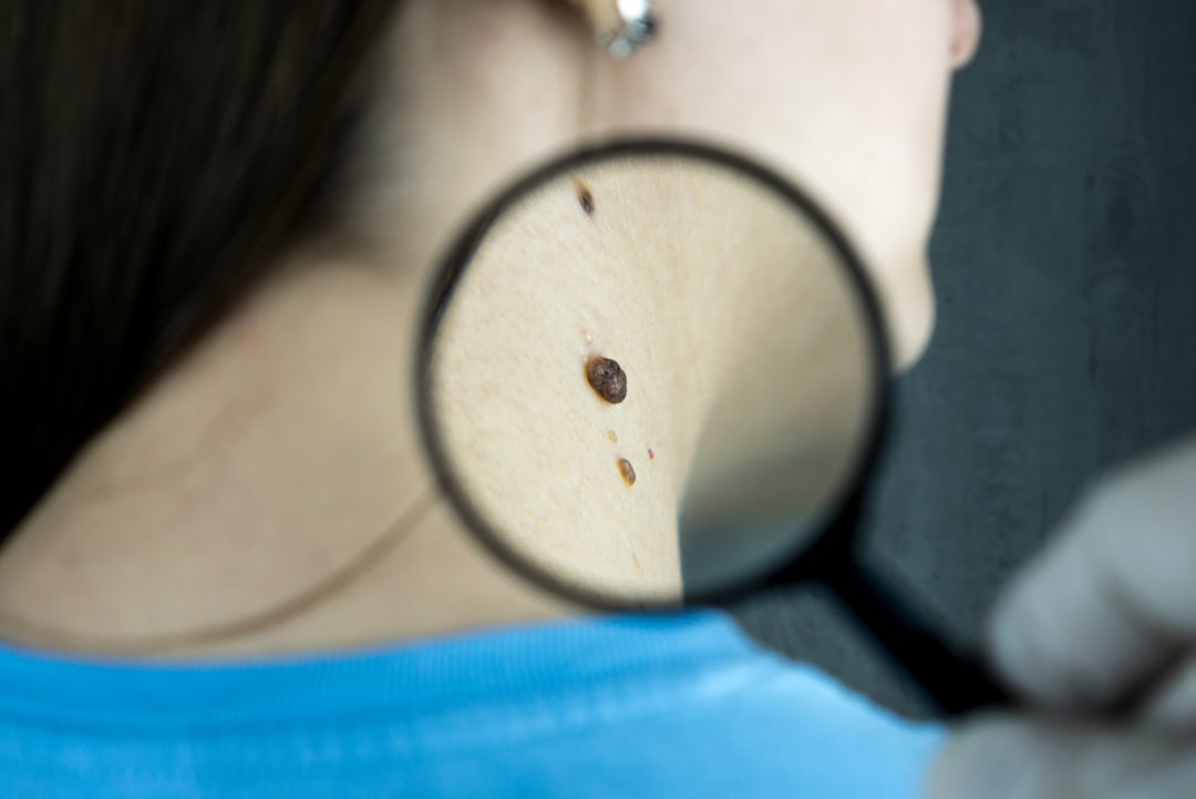 trouvez un dermatologue qualifié près de chez vous. consultez pour le traitement des maladies de la peau, soins anti-âge, conseils dermatologiques et solutions personnalisées pour une peau saine.