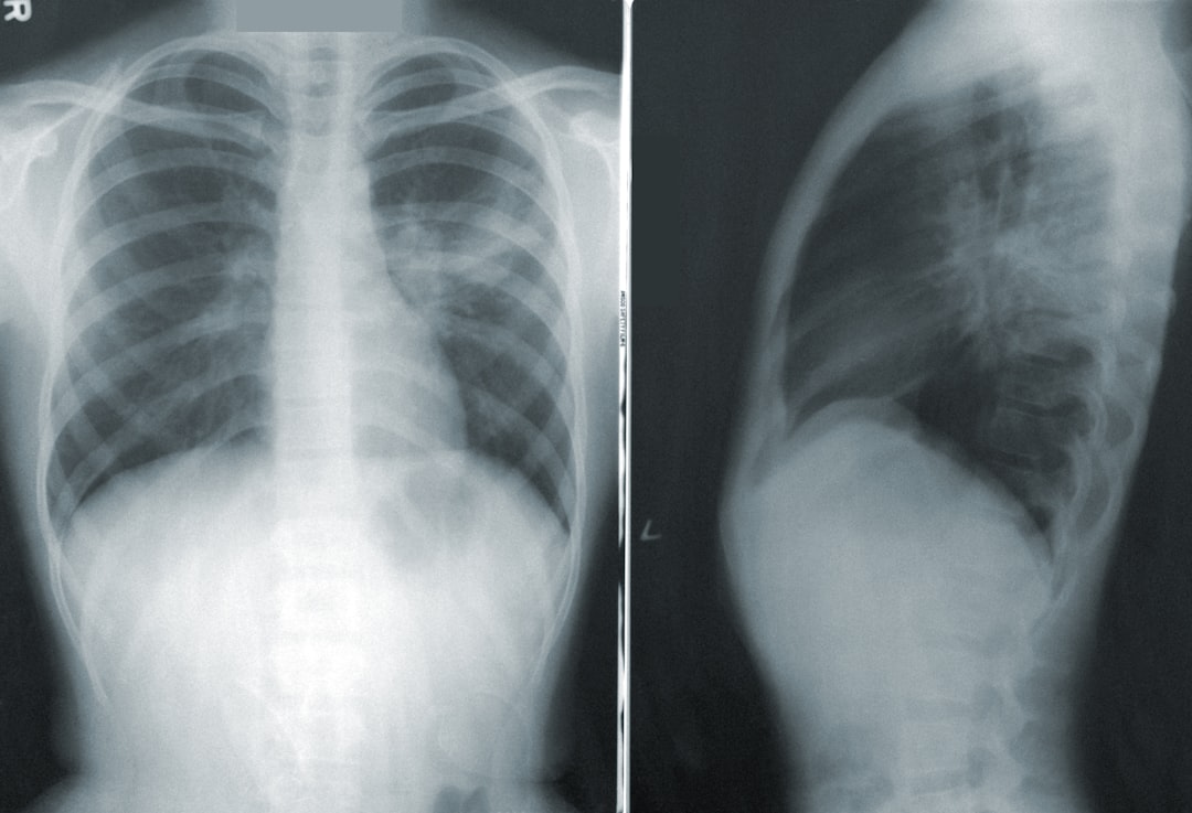 découvrez le rôle essentiel du radiologue, expert en imagerie médicale, pour diagnostiquer et accompagner vos soins grâce à des examens précis et fiables.